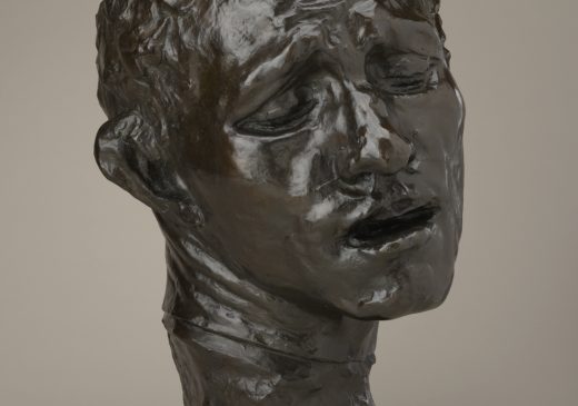 A bronze sculpture of a man’s head that is tilted to one side. He is looking down, with his eyes nearly closed and his mouth slightly open. His pained facial expression makes him appear to be in distress.